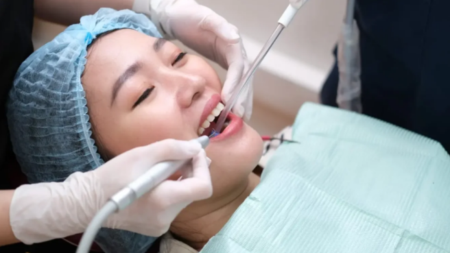 Ilustrasi cara scaling gigi pakai BPJS